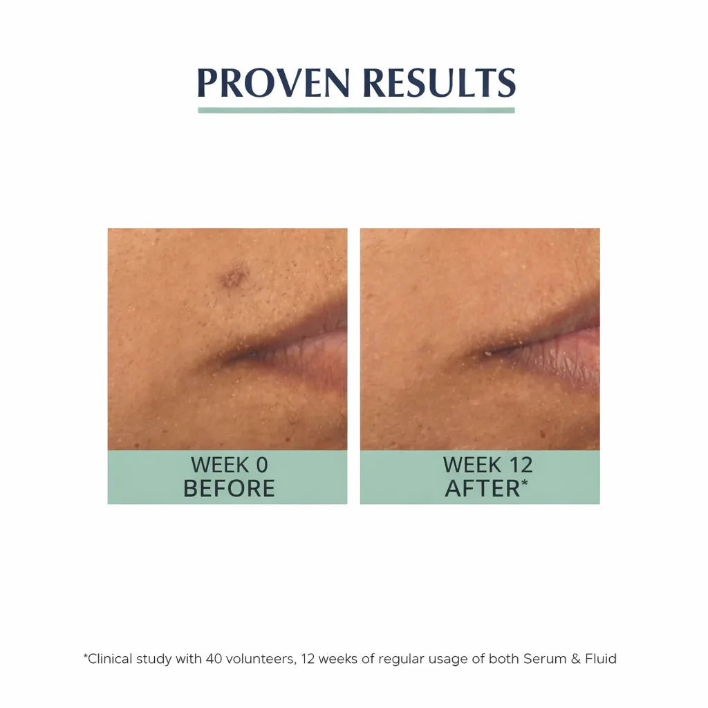 Eucerin DermoPure Protective Fluid SPF 30 clinical results before and after 12 weeks