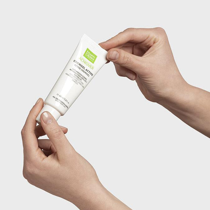 Acniover Active Cremigel 40 ml – Martiderm acne treatment gel held in hand for size reference